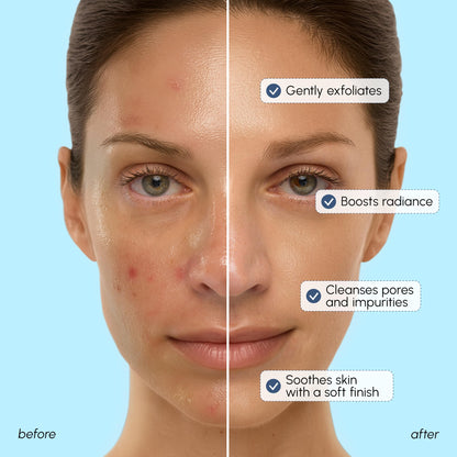 MAREE Face Exfoliator – Microdermabrasion Facial Scrub & Exfoliating Face Wash for Women – Collagen & Glycolic Acid – Gentle Scrub and Exfoliant MAREE