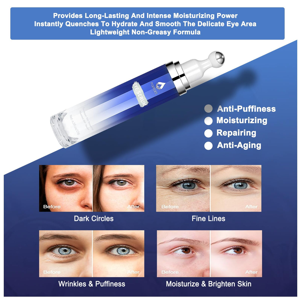 Eye Serum with 8% Caffeine & 8% Retinol Under Eye Cream 0.5 Fl Oz POEROES