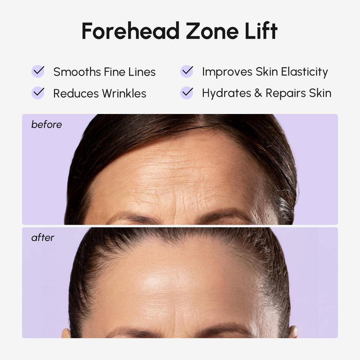 MAREE Forehead Wrinkle Patches – Collagen Wrinkle Patches with Retinol & Hyaluronic Acid for Face Lift – Fine Lines Deep Forehead Wrinkles Treatment Remover – Face Tape for Wrinkles Between Eyebrows MAREE