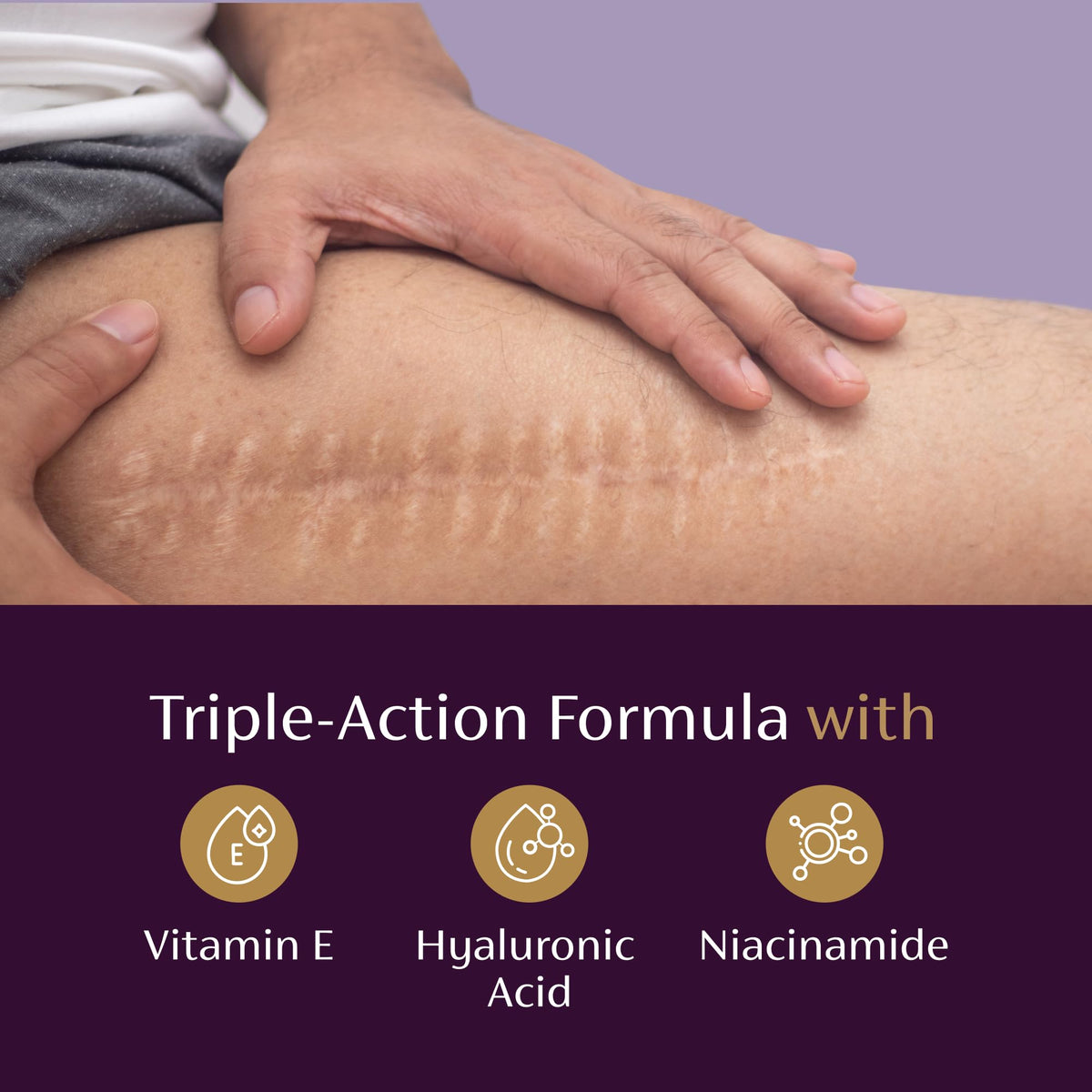Mederma Scar Serum for Old Scars, Triple-Action with Niacinamide, 1 Fl Oz Mederma