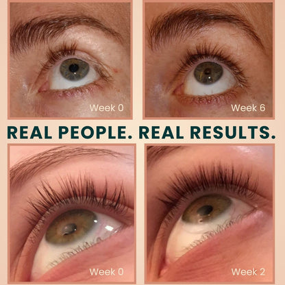 Organic Castor Oil Lash Serum for Eyelash Growth Serum and Eyebrow Growth Live Fraiche