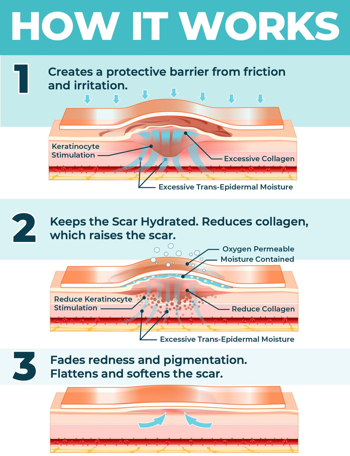 Medical Grade Silicone Scar Tape - 1.6"x150" - Effective Scar Removal MYHELP