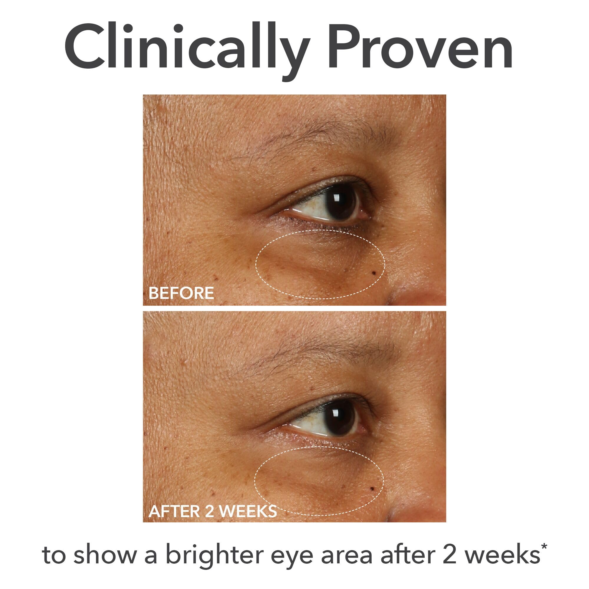Dr Dennis Gross DermInfusions Fill + Repair Eye Cream: Hydrating & Brightening Treatment for Dark Circles, Fine Lines & Wrinkles, Firms & Smooths 360° Eye Area, 0.5 Oz Dr Dennis Gross buy australia supplements