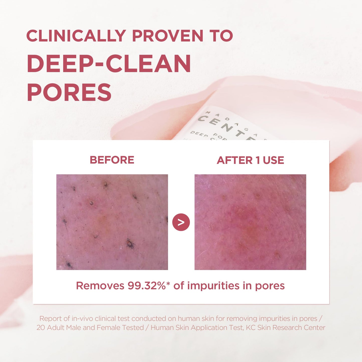 SKIN1004 Poremizing Deep Cleansing Foam, 4.23 fl.oz, 125ml, Makeup Remover, Korean Face Cleanser with Himalayan Pink Salt SKIN1004