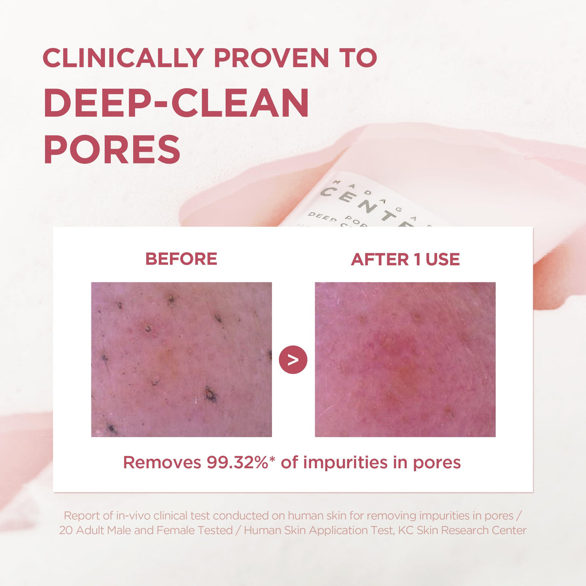 SKIN1004 [Hudson's Pick Poremizing Deep Cleansing Foam, Makeup Remover, Korean Face Cleanser with Himalayan Pink Salt & Centella for Facial Pore Cleansing, Korean Skin Care, 4.23 fl.oz, 125ml SKIN1004