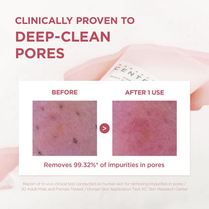 SKIN1004 [Hudson's Pick Poremizing Deep Cleansing Foam, Makeup Remover, Korean Face Cleanser with Himalayan Pink Salt & Centella for Facial Pore Cleansing, Korean Skin Care, 4.23 fl.oz, 125ml SKIN1004