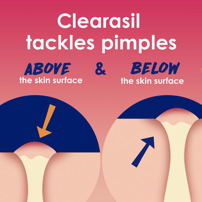 Clearasil Rapid Rescue Deep Treatment Acne Face Pads, Maximum Strenght with 2% Salicylic Acid Acne Treatment Medicine, 90 Count Clearasil