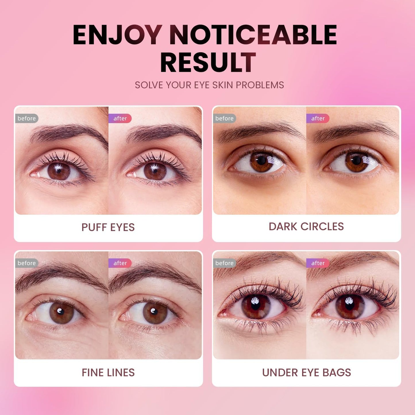 AILEORY Under Eye Patches (24 Pairs) - Tri-color Glitter Eye Gel Pads for Dark Circles, Puffy Eyes, Under eye Bags, Wrinkles AILEORY