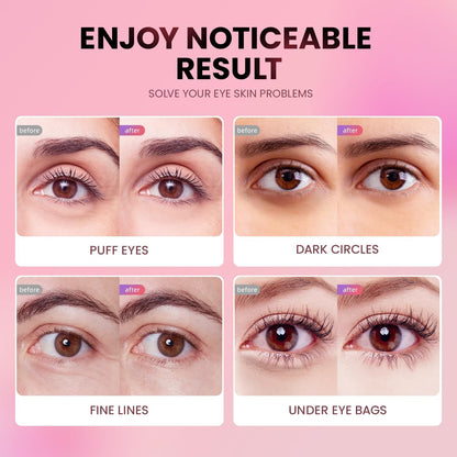 AILEORY Under Eye Patches (24 Pairs) - Tri-color Glitter Eye Gel Pads for Dark Circles, Puffy Eyes, Under eye Bags, Wrinkles AILEORY