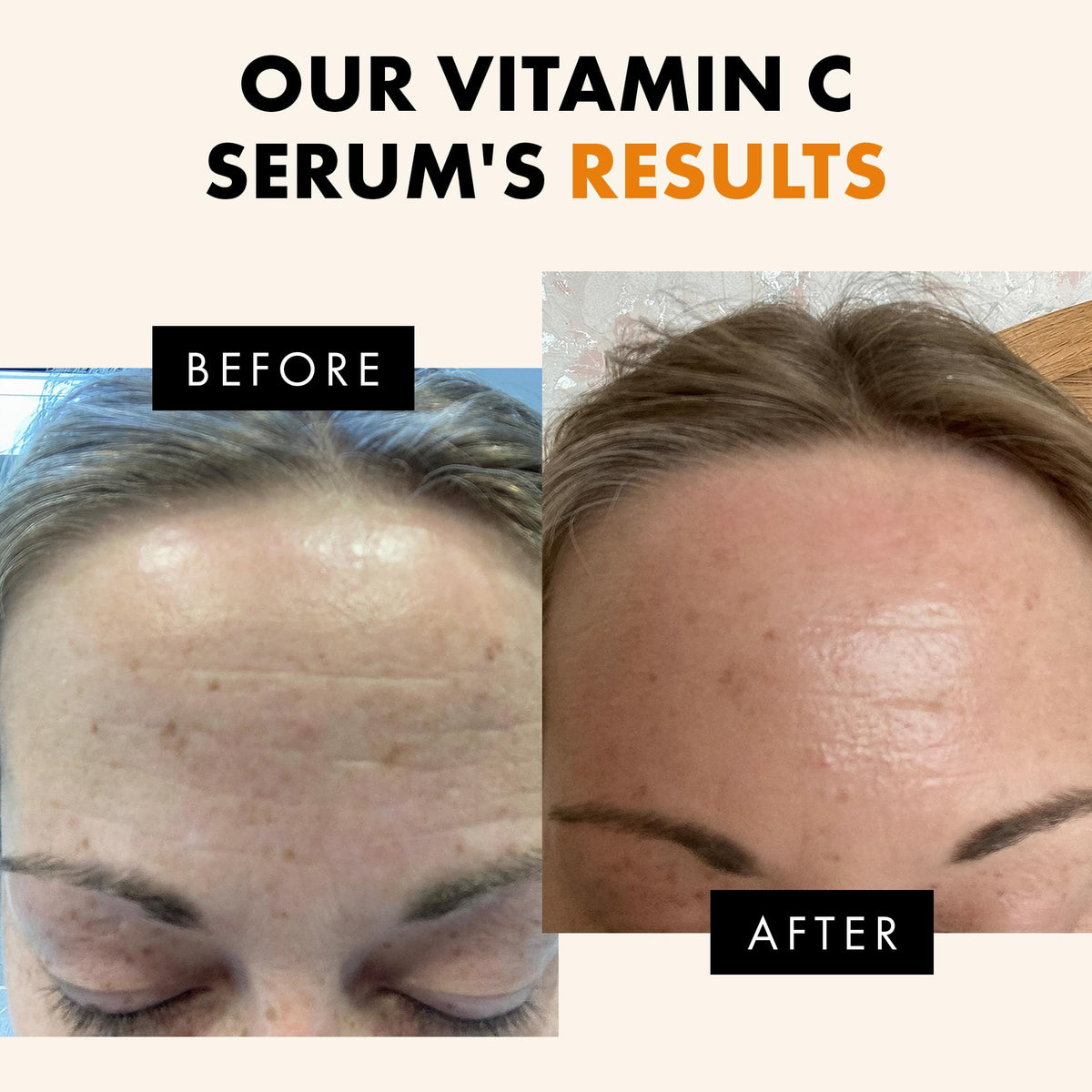 Eclat Skincare Vitamin C Serum - Skin Care for Dark Spots, Vitamin C Serum for Face with Hyaluronic Acid, Ferulic Acid, & Vit E - Anti Aging and Skin Brightening Vit C Formula for Face Care 1 Fl Oz Eclat Skincare
