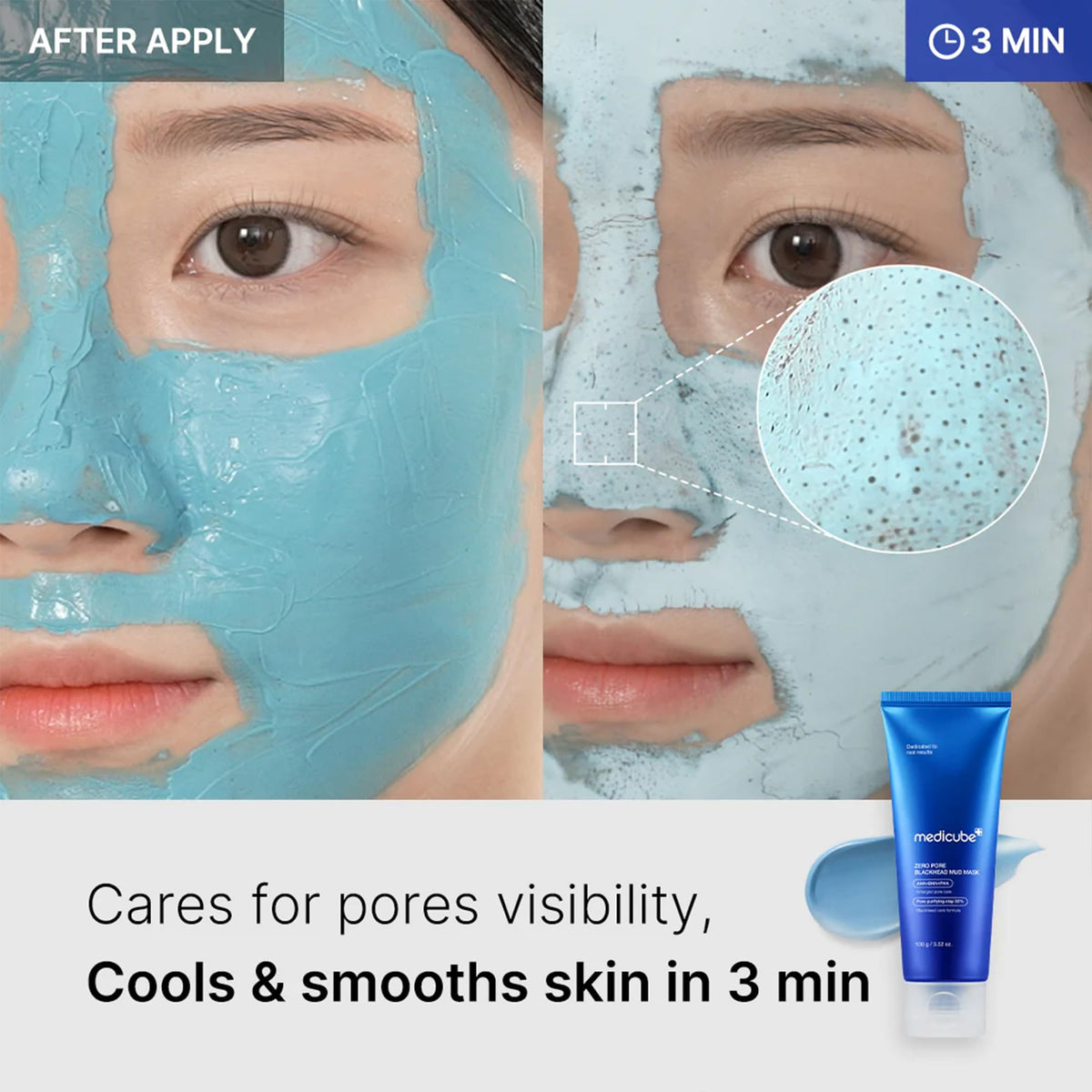 medicube Zero Pore Blackhead Mud Mask - Pore Cleansing & Gentle Exfoliating medicube
