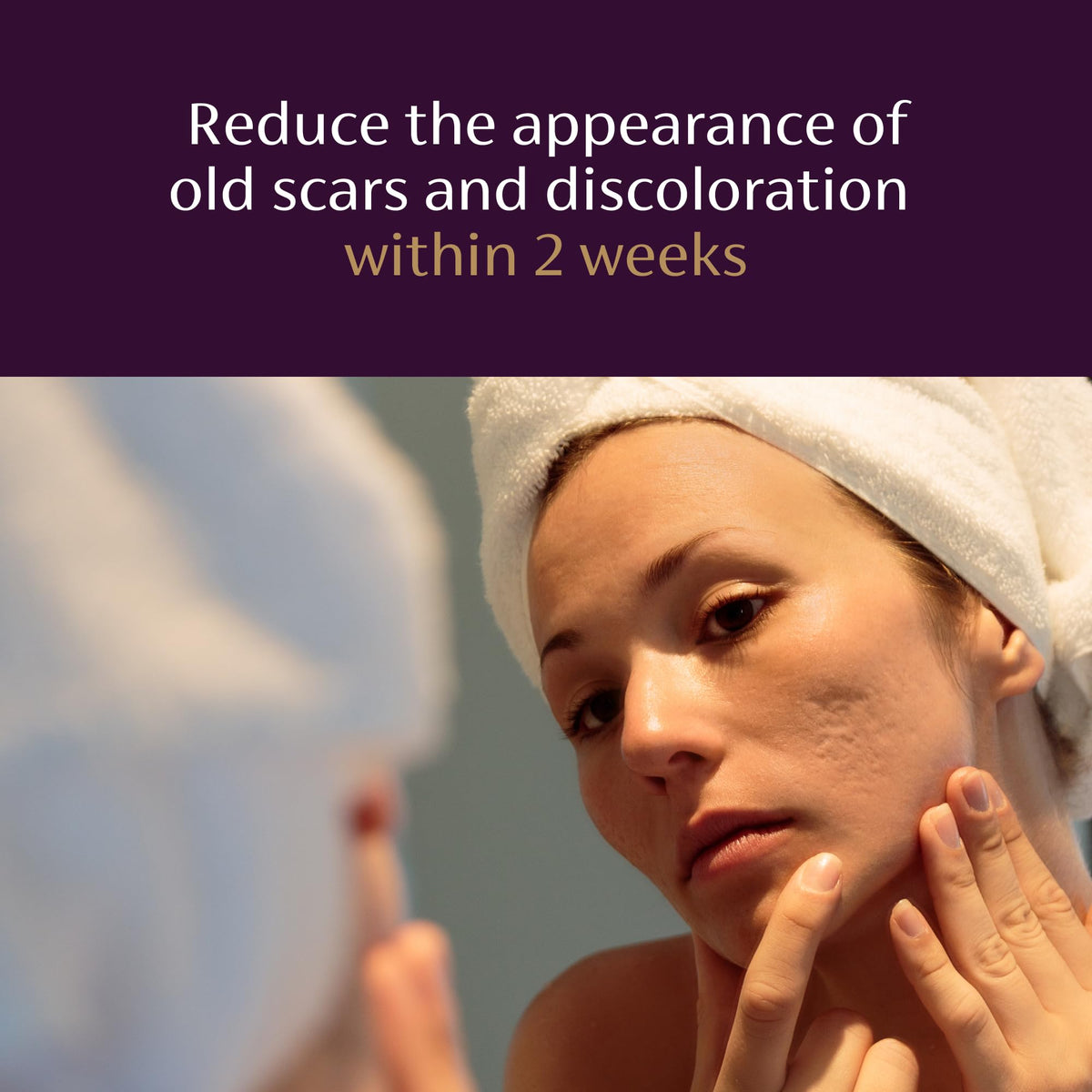 Mederma Scar Serum for Old Scars, Triple-Action with Niacinamide, 1 Fl Oz Mederma