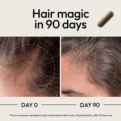 Moon Juice SuperHair Hair Growth Vitamins for Women & Men with Biotin & Saw Palmetto - Clinical Strength Multivitamin Hair Supplement for Healthier, Stronger, Thicker Hair, 120 Capsules - 30 Servings