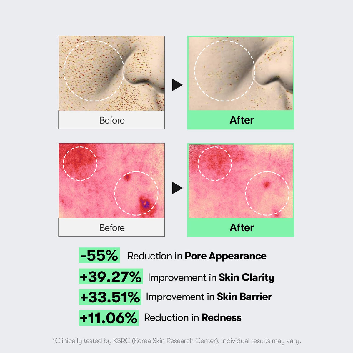 VT COSMETICS CICA Reedle Shot 100 Microneedling Serum VT COSMETICS