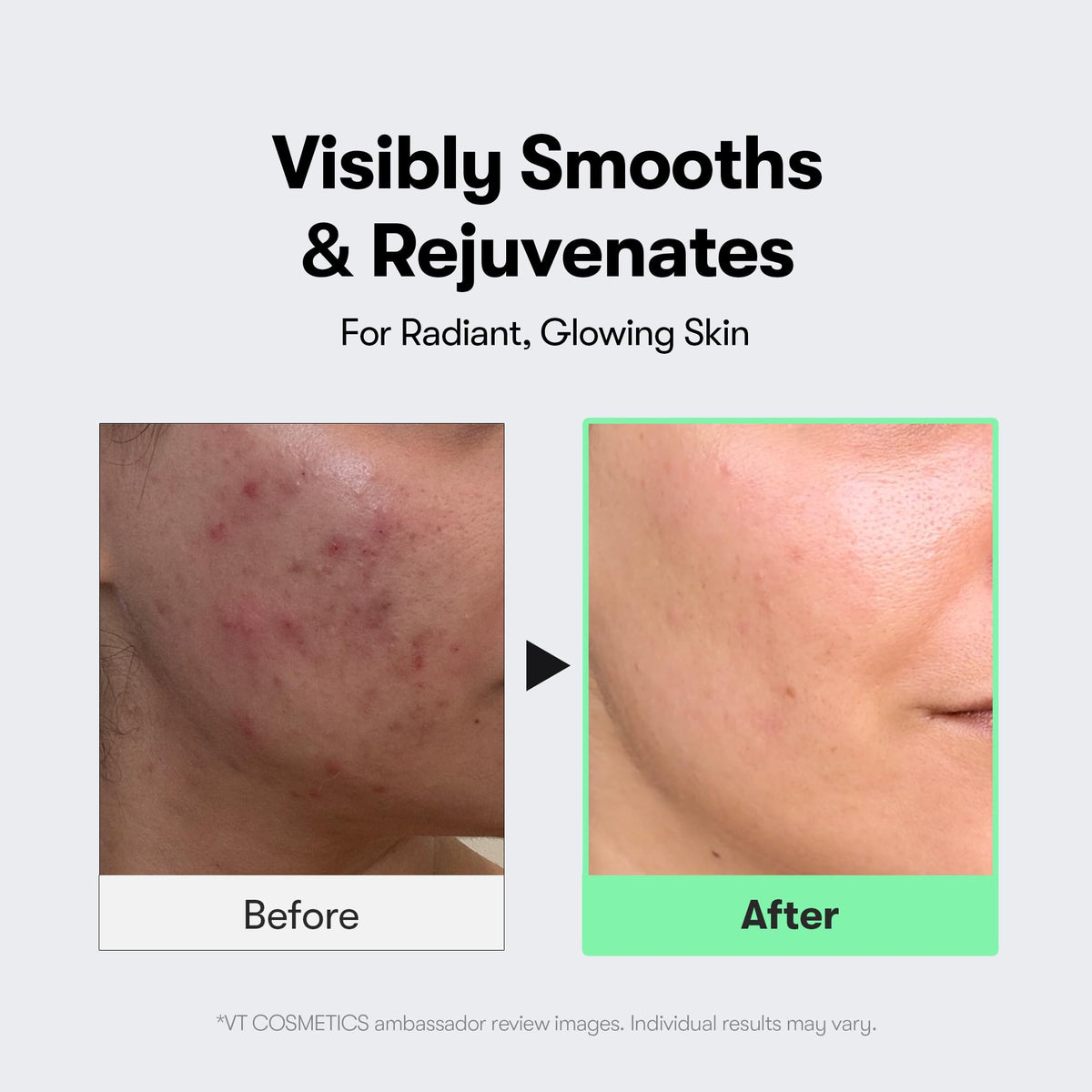VT COSMETICS CICA Reedle Shot 100 Microneedling Serum VT COSMETICS