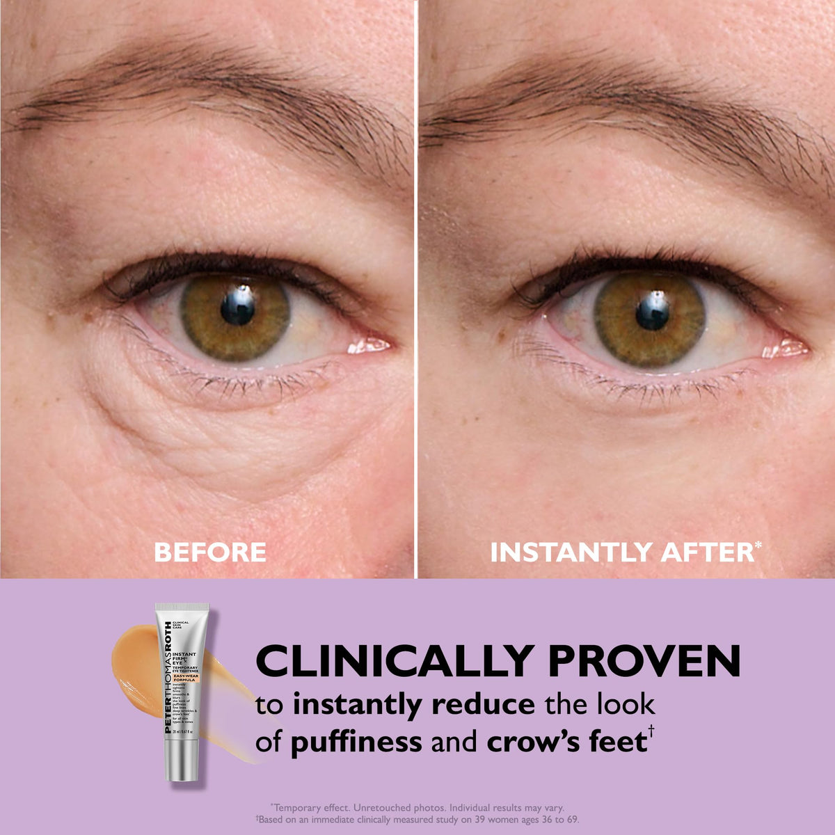 Peter Thomas Roth | Instant FIRMx® Eye Temporary Eye Tightener Easy-Wear Formula | For Firming Under-Eye Bags & Wrinkles Peter Thomas Roth