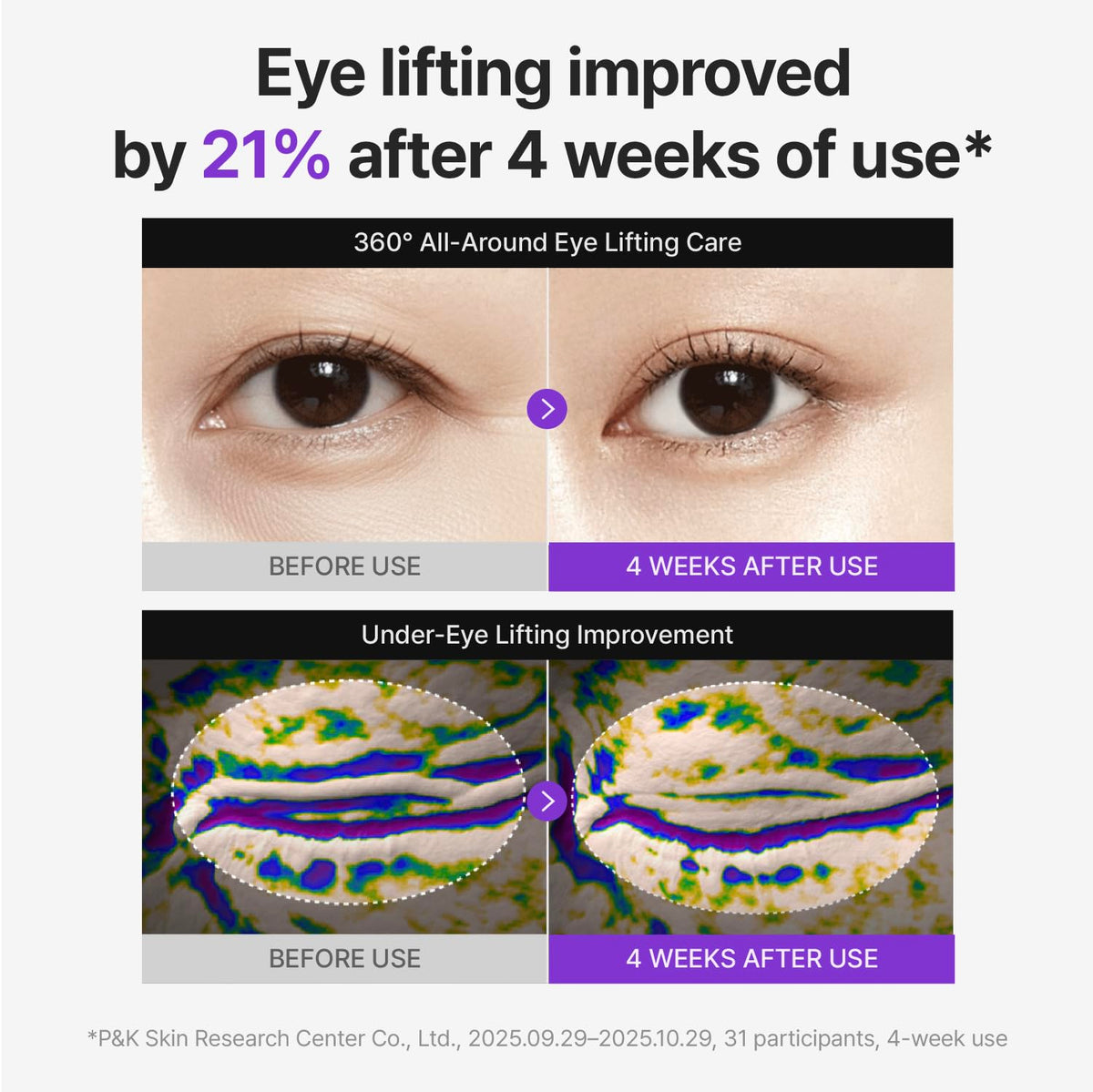 CENTELLIAN 24 360 Shot PDRN Firming Eye Cream, TECA Retinol Care CENTELLIAN 24
