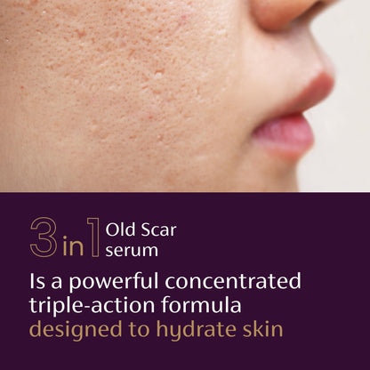 Mederma Scar Serum for Old Scars, Triple-Action with Niacinamide, 1 Fl Oz Mederma