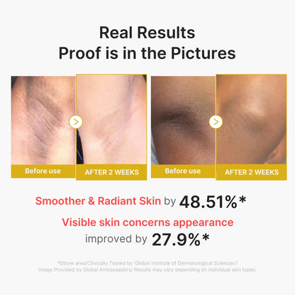 medicube Body Peel Shot with Kojic Acid and Turmeric medicube