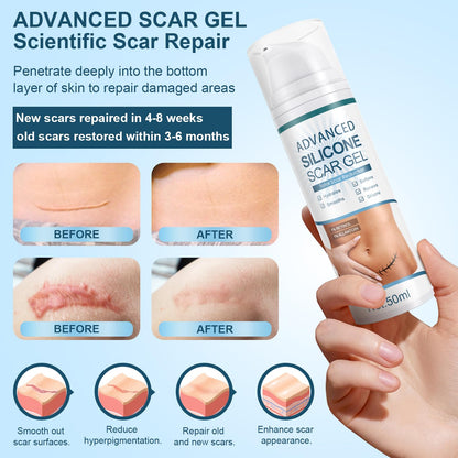 Mitgary Advanced Scar Gel, Silicone Scar Gel, Treats Old and New Scars, Reduces the Appearance of Scars from, Body, Face, Stretch Marks, Surgical Scar, Keloids, Acne, Burns and More, 50g (1.7 Oz) Mitgary