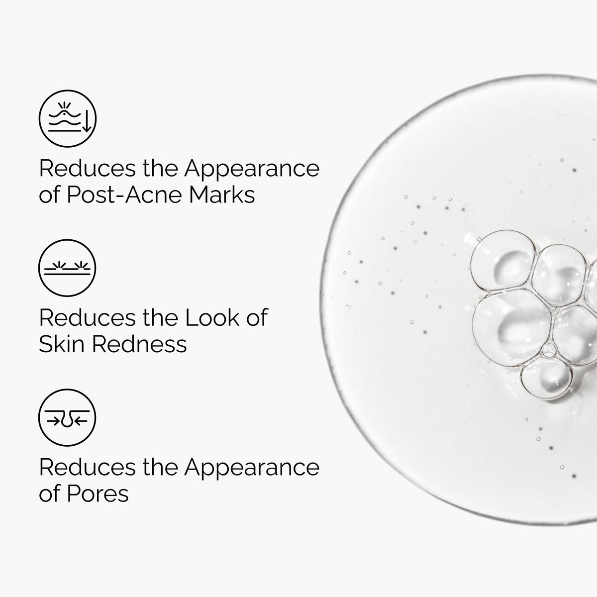 The Ordinary Aloe 2% + NAG 2% Solution, Soothes Skin and Targets Post-Acne Marks, 1 Fl Oz The Ordinary