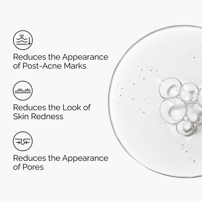 The Ordinary Aloe 2% + NAG 2% Solution, Soothes Skin and Targets Post-Acne Marks, 1 Fl Oz The Ordinary