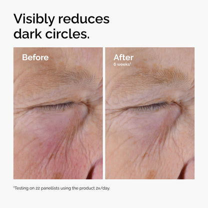 The Ordinary Caffeine Solution 5% + EGCG Eye Serum, Depuffing Eye Serum for Dark Circles and Tired Eyes, 1 Fl Oz The Ordinary