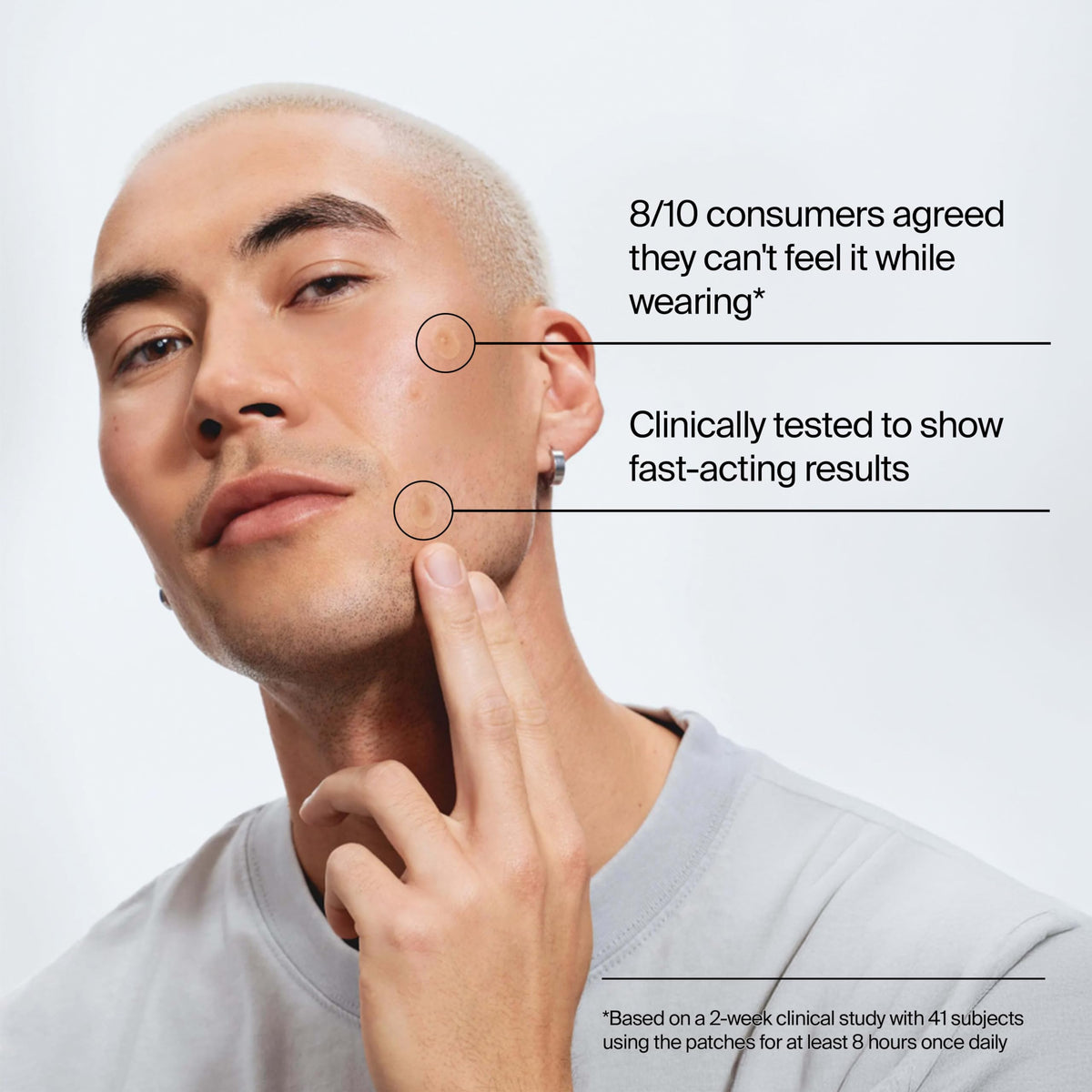 Neutrogena Stubborn Acne Patches, Ultra-Thin Pimple Patches, 24 Ct Neutrogena