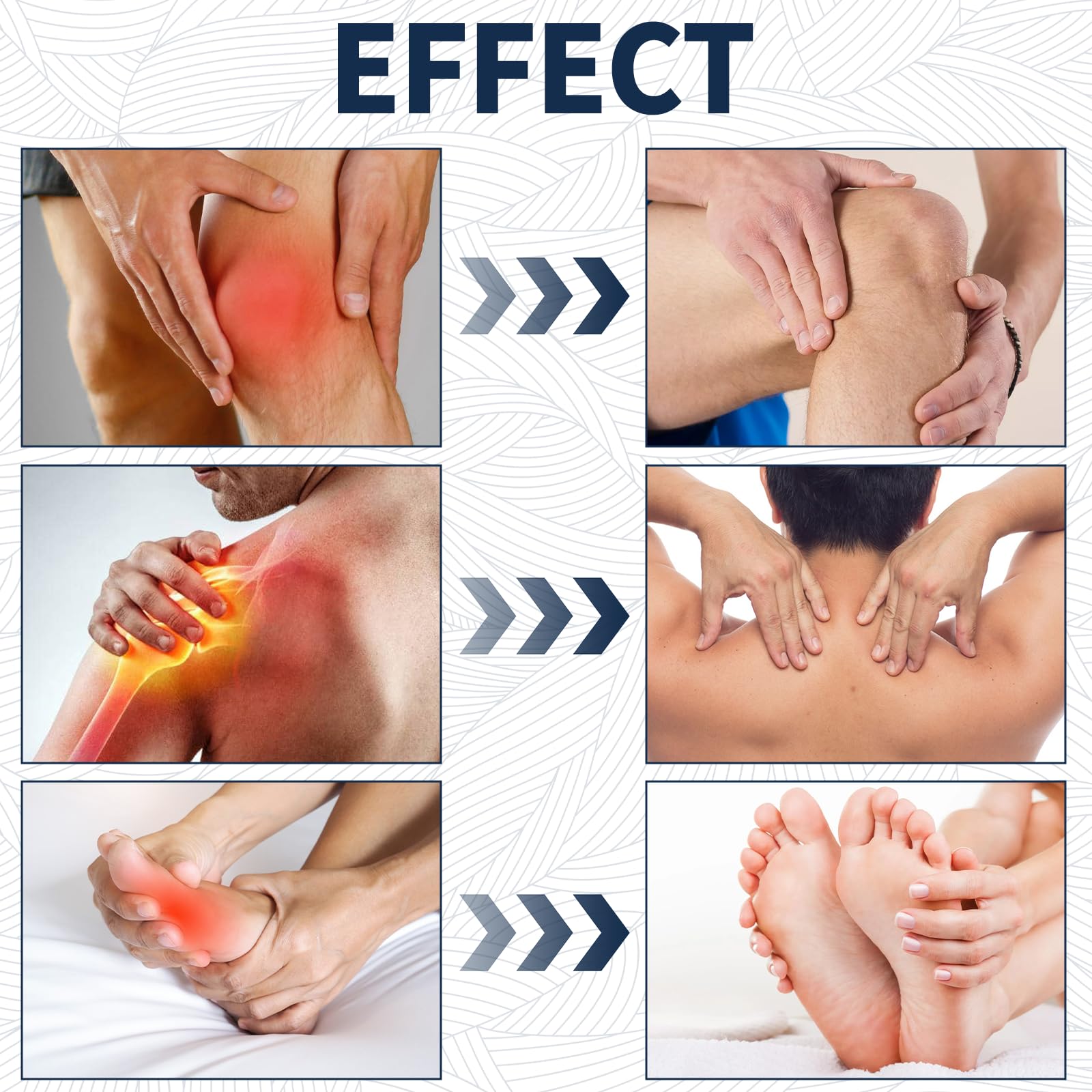 YIVANNUO 2PCS Neuropathy Relief Cream, Contains Arnica, Menthol, Msm, and Glucosamine, Suitable for Feet, Hands, Legs, Muscles, Joints, and Waist, Fast Absorption, Mild & All Natural YIVANNUO buy australia supplements
