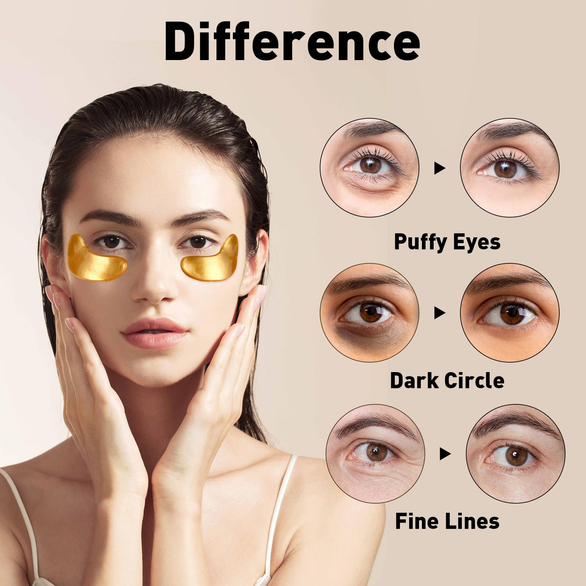 CHMI 24K Gold Under Eye Patches 50 Pairs Collagen, Dark Circles, Wrinkles CHMI