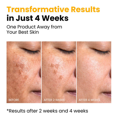 QUIA Turmeric + Kojic Acid Overnight Wrapping Mask – Hydration Mask for Glowing Skin QUIA Beauty