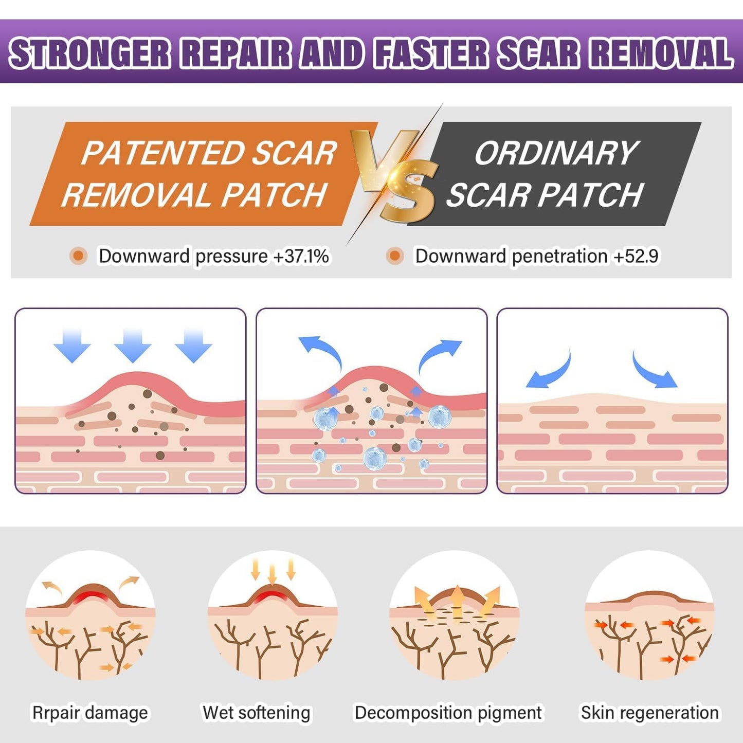 Silicone Scar Sheets,Silicone Scar Tape,Silicone Scar Removal Strips for Surgical,C-Section,Tummy Tuck,Keloid Scars Psecici