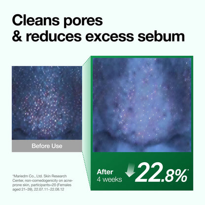 Anua Heartleaf Pore Control Cleansing Oil, Korean Skincare, 6.76 fl.oz ANUA