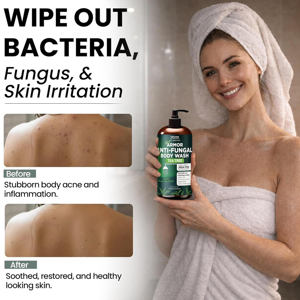 Antifungal Body Wash with Tea Tree Oil for Ringworm & Jock Itch w/Scrubber Terramed Just Think Comfort