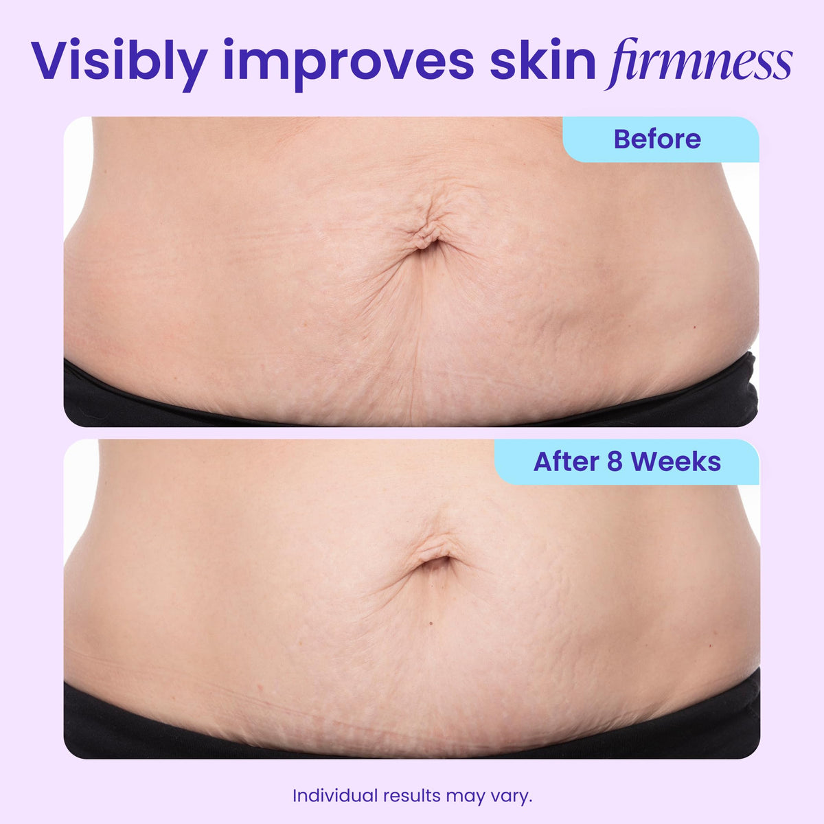 GOPURE Tighten & Smooth Belly Cream - Clinically Tested with MicroTight4 Complex to Reduce the Appearance of Cellulite & Stretch Marks - Quick Absorbing for Smoother, Firmer-Looking Skin, 4.25oz goPure