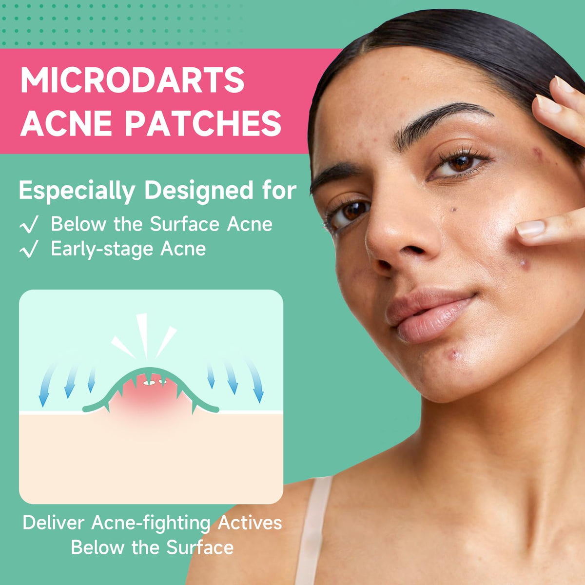 TEAWOO 36-Count Microdart Pimple Patches, Hydrocolloid Acne Patches with Salicylic Acid & Madecossoside, Microdart Zit Patches for Deep Blemishes & Early Stage Acne (Patented) TEAWOO