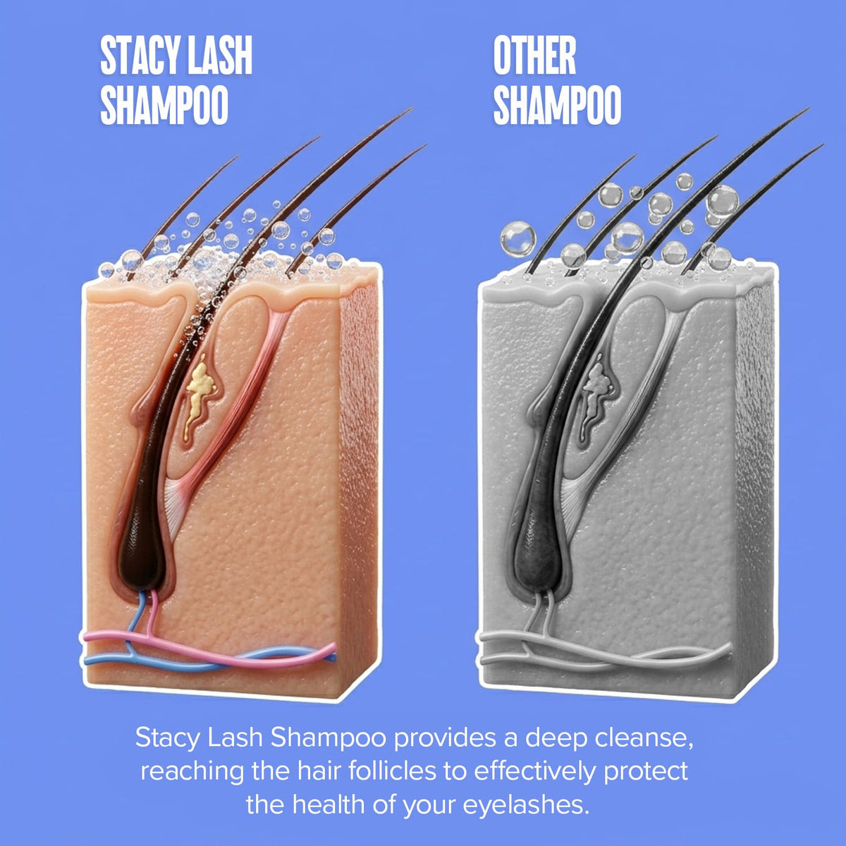 STACY LASH Eyelash Extension Shampoo + Brush / 1.69 fl.oz / 50ml / Korean Makeup Remover/Eyelid Foaming Cleanser/Wash for Extensions & Natural Lashes/Supplies for Professional & Home Use STACY LASH