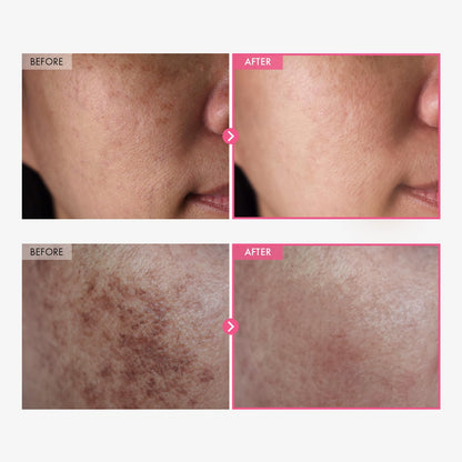 TOSOWOONG Arbutin 7% + Tranexamic Acid 4% Cream for Dark Spots, Brightening TOSOWOONG