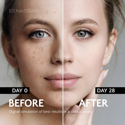 EnaSkin Dark Spot Remover Face & Body Serum: Age Spot Sun Spot Freckles Melasma Brown Spot EnaSkin