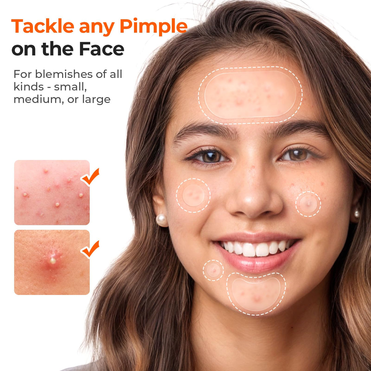TKTK 443 Count Pimple Patches for Face, Hydrocolloid Acne Cover Patch Bulk TKTK