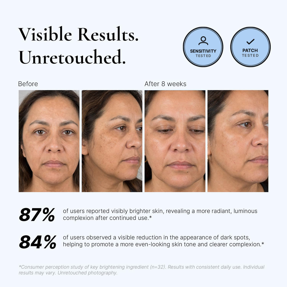 EnaSkin Dark Spot Corrector & Remover Serum for Face & Body, Niacinamide EnaSkin