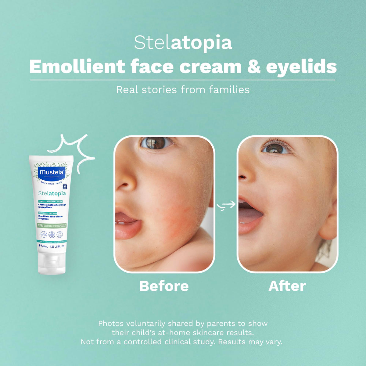 Mustela Stelatopia Eczema-Prone Skin Emollient Baby Face Cream - Face Moisturizer with Natural Avocado & Sunflower Oil - Fragrance-Free - 1.35 fl. oz. Mustela