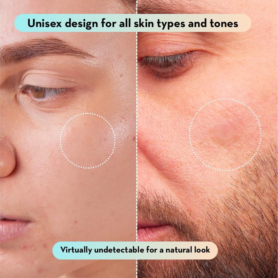 LE GUSHE Korean Pimple Patches for Face (132 Dots) - Hydrocolloid Acne Patches & Zit Patches with Tea Tree Oil - Invisible Blemish Patches - Dermatologist Tested Korean Skin Care LE GUSHE