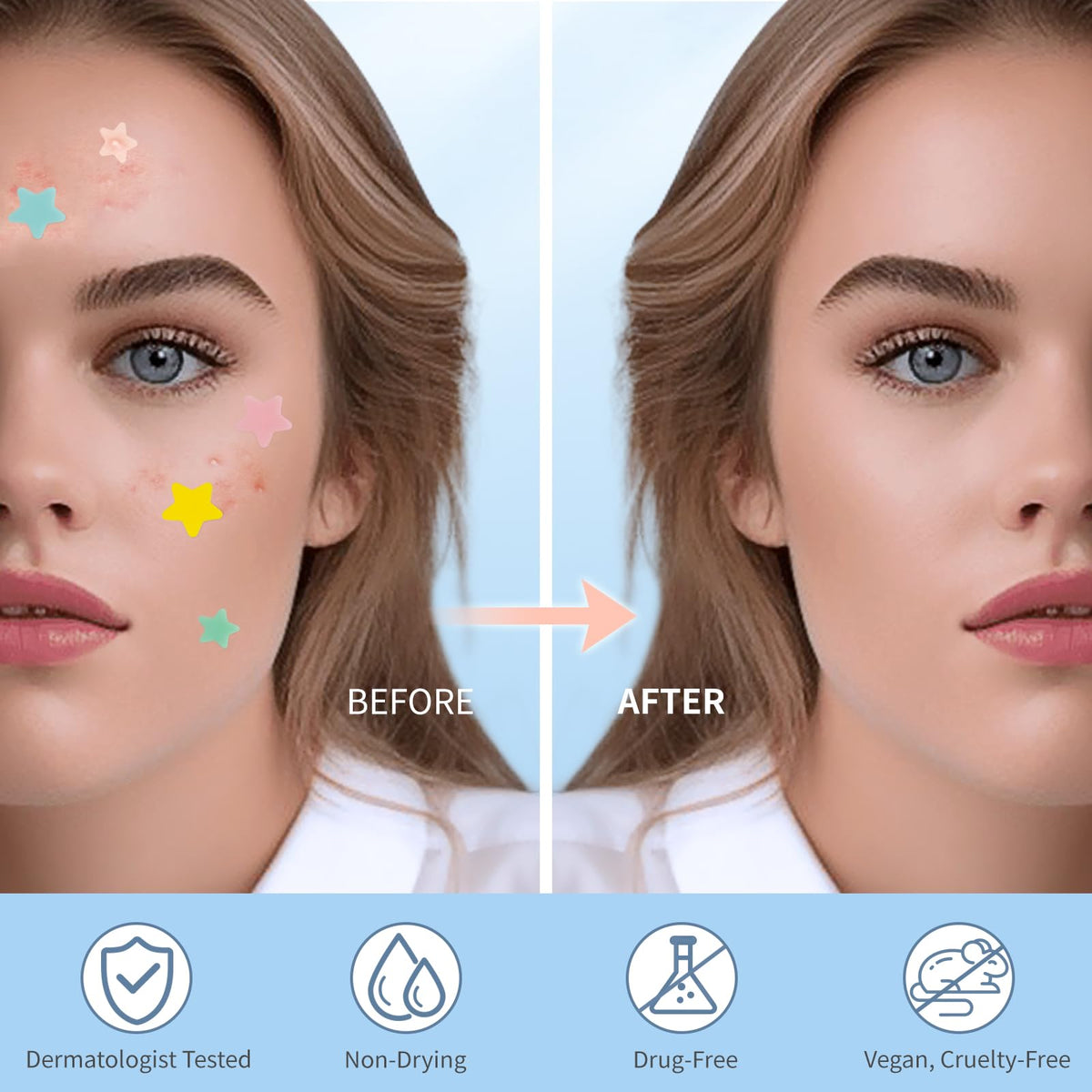 QUSTERE Pimple Patches for Face, Hydrocolloid Acne Patches, Cute Star Zit Covers, Colorful Spot Stickers with Tea Tree, Salicylic Acid & Cica Oil| 3 Sizes (10mm, 12mm & 14mm) |200 Count QUSTERE