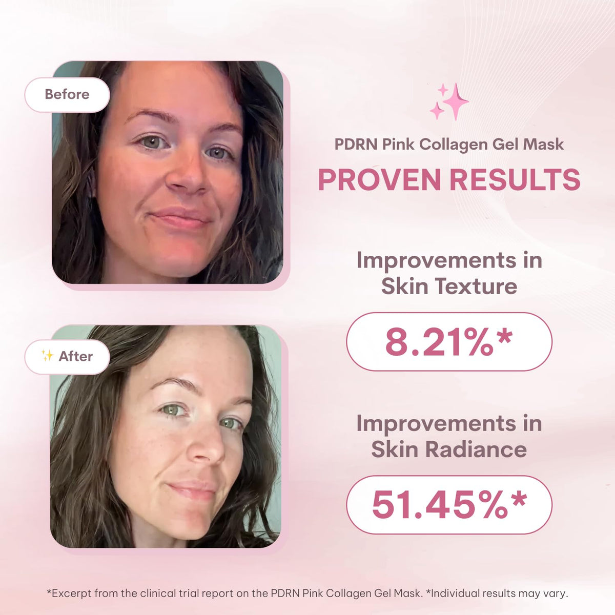 Quasi Salmon PDRN Collagen Mask – Korean Skin care Gel Face Mask for Hydration, Firming & Smoothing Skincare, Collagen Boost & Pore Care – 4 Masks, Non-Irritating, Natural Ingredients Quasi