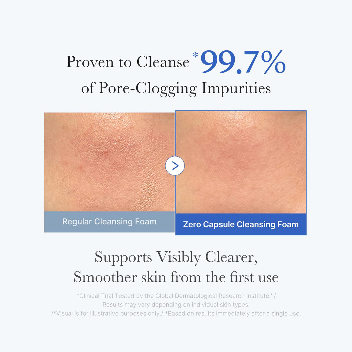 medicube Facial Cleanser Zero Pore Capsule Cleansing Foam medicube