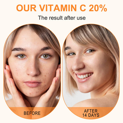 Premium 20% Vitamin C Serum For Face with Hyaluronic Acid, Retinol & Amino Acids - Boost Skin Collagen,Hydrate & Plump Skin, Anti Aging & Wrinkle Facial Serum 60ml ELBBUB