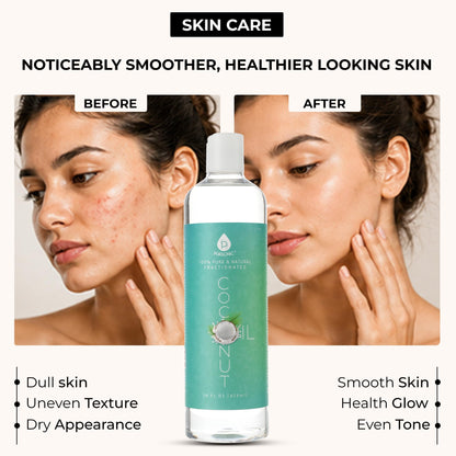 Pursonic Pure Unscented Fractionated Coconut Oil - 16 Oz Multipurpose Oil for Skin, Hair, Body Massage & Makeup Removal - Carrier Oil for Essential Oils and Aromatherapy Pursonic