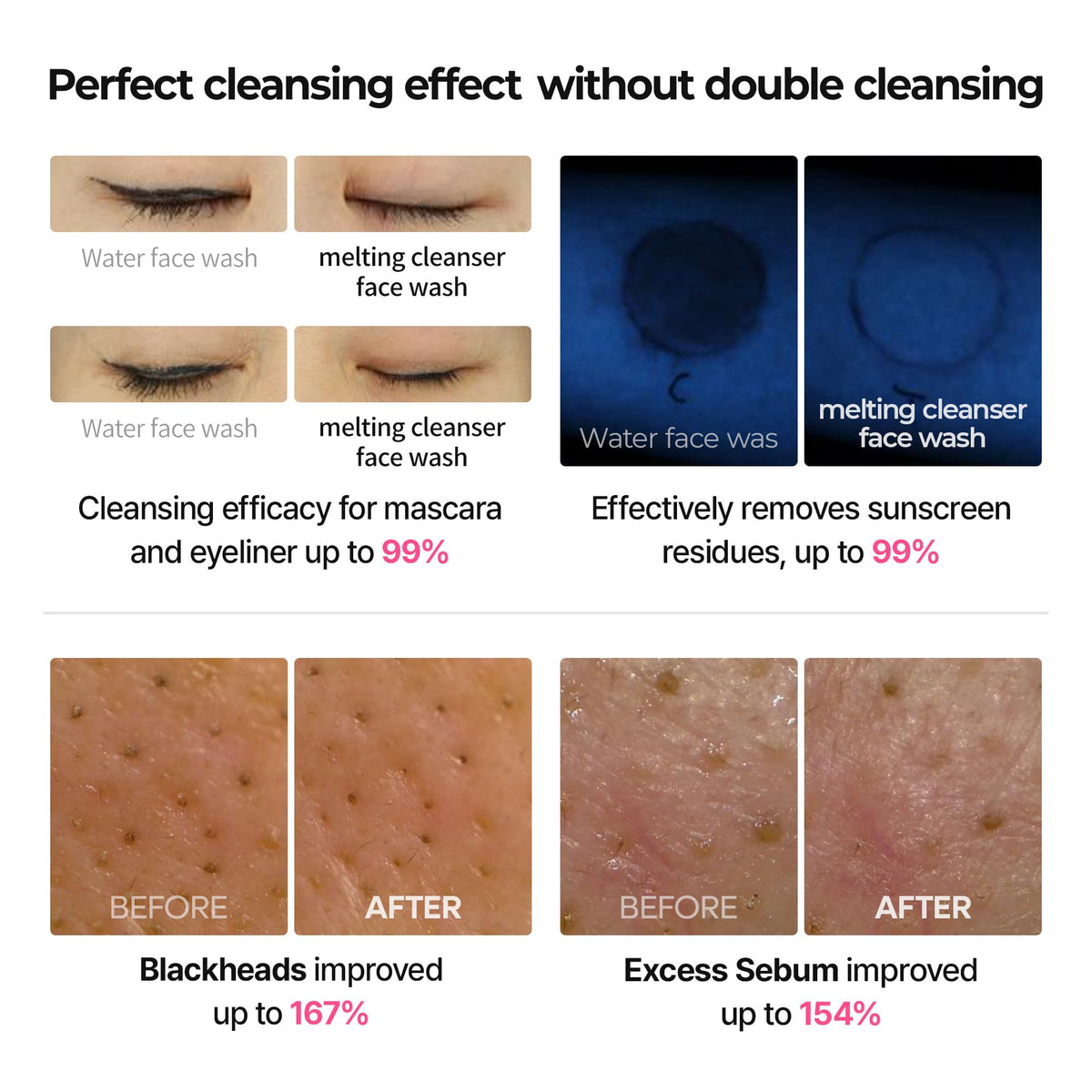 Dr.Melaxin Melting Bubble Foaming Cleanser - Micellar Makeup Remover Face Wash with Calamine and Niacinamide, No Double Cleansing Needed, Gentle Foam Cleanser for Sensitive Skin, K-Beauty Dr.Melaxin