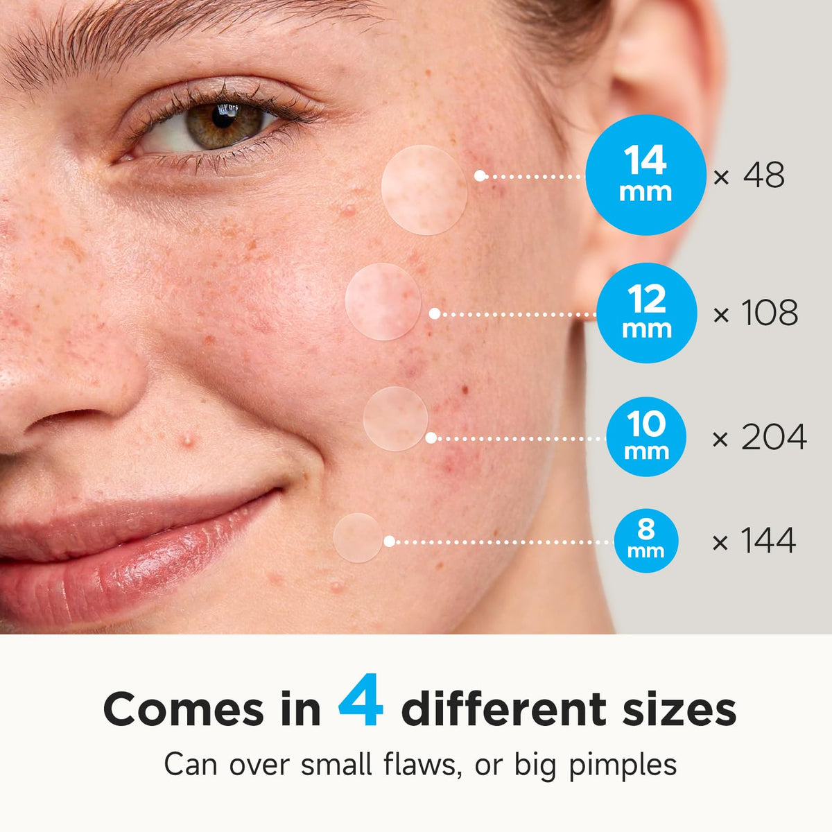 Glowpatch 504 Counts 4 Sizes Hydrocolloid Pimple Patches for Face Glowpatch